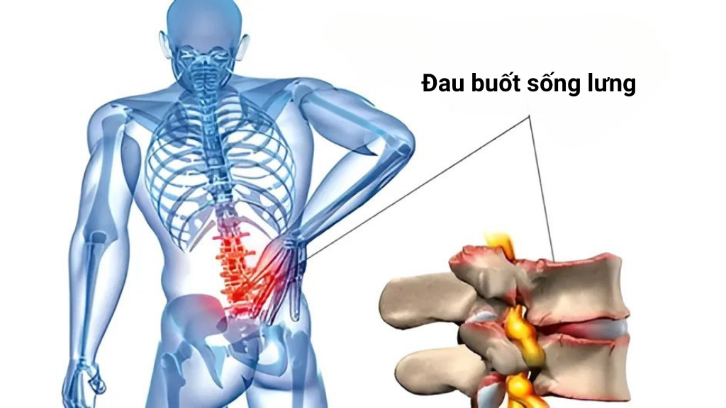 Dau buot song lung