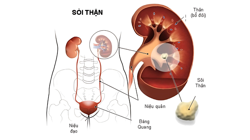 Soi than