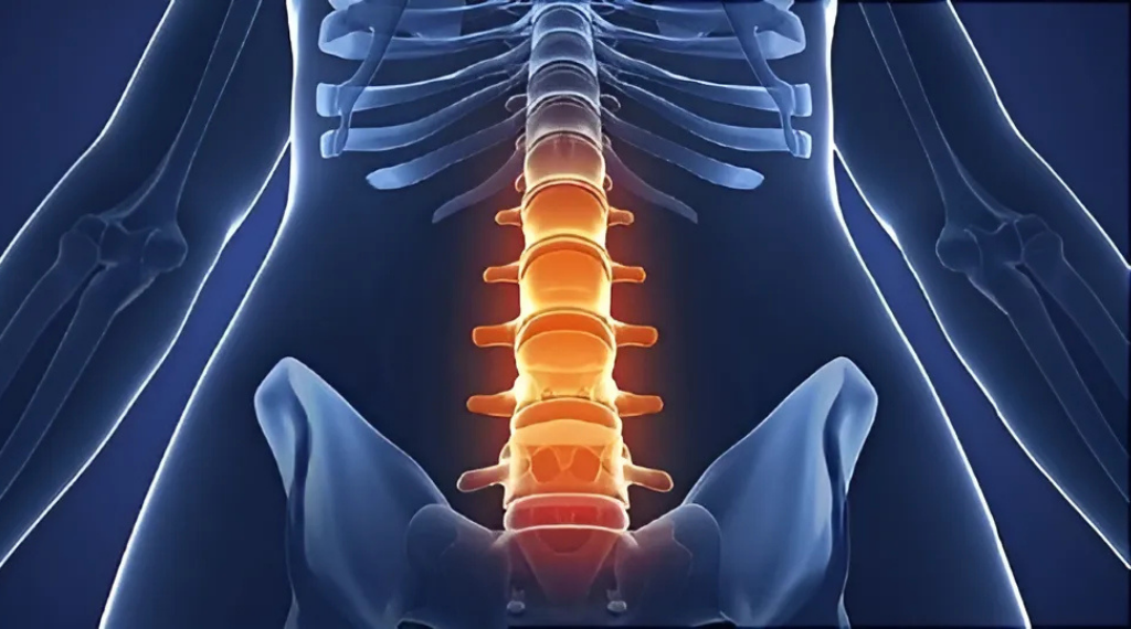 thoái hóa cột sống